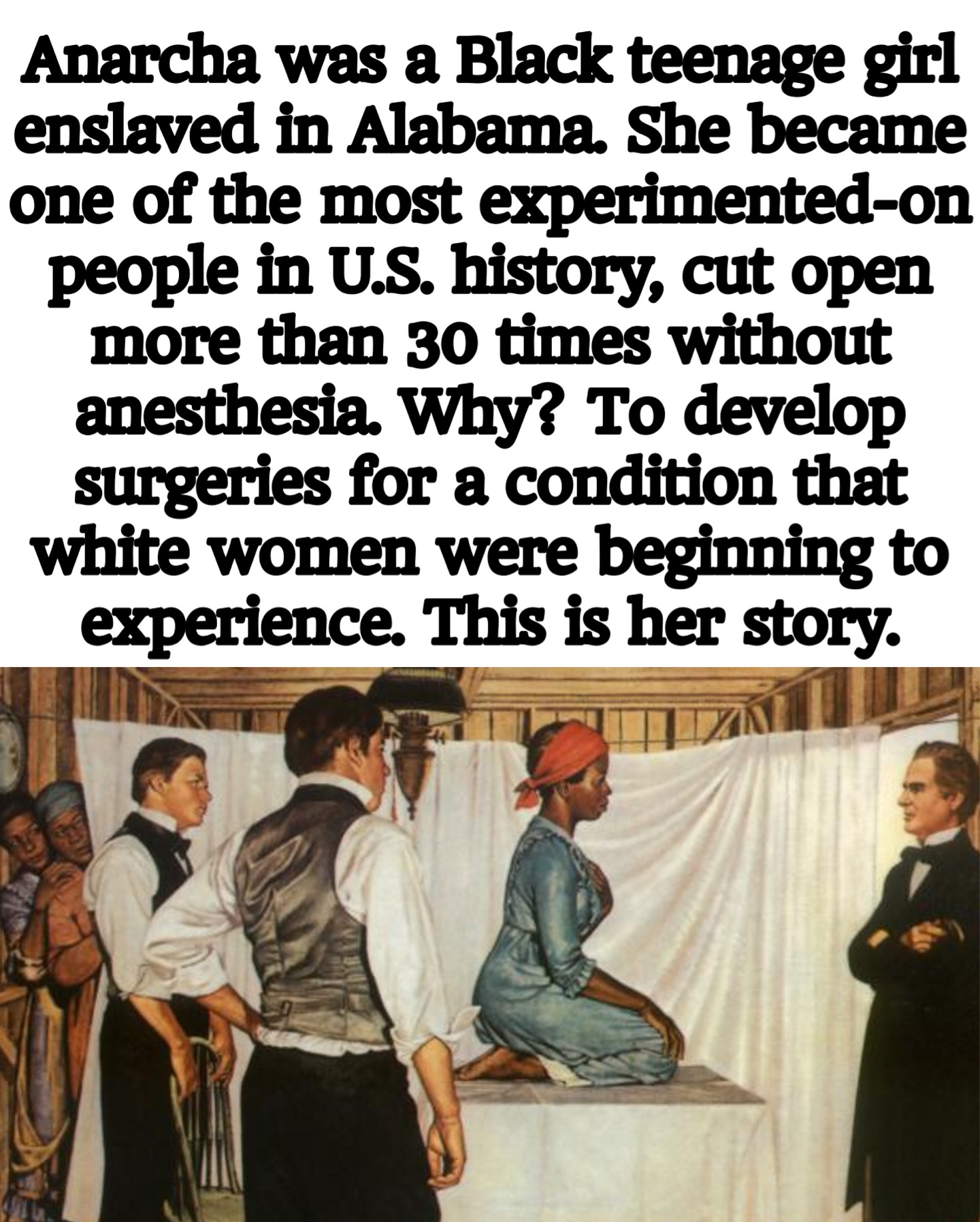 Anarcha Westcott: Remembering the Mother of Gynecology Denied Dignity Anarcha Westcott: Remembering the Mother of Gynecology Denied Dignity