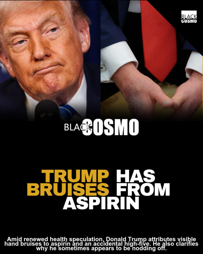 Donald Trump Blames Hand Bruises On Aspirin; Brushes Off Health Concerns And Denies Sleeping In Public Donald Trump Blames Hand Bruises On Aspirin; Brushes Off Health Concerns And Denies Sleeping In Public