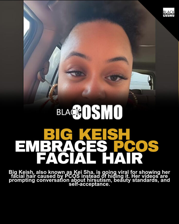Big Keish Flaunts PCOS Beard, Goes Viral Big Keish Flaunts PCOS Beard, Goes Viral